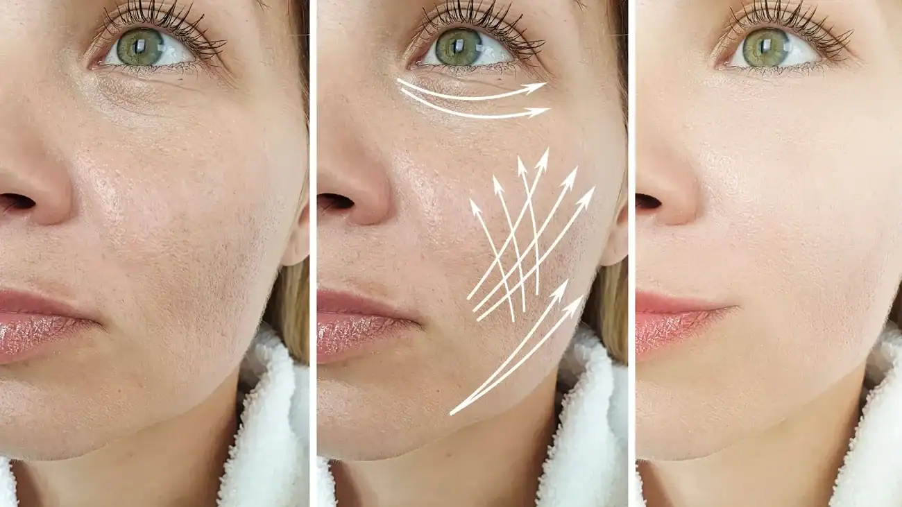 Can One Treatment Really Tackle More Than One Skin Concern East Kilbride?