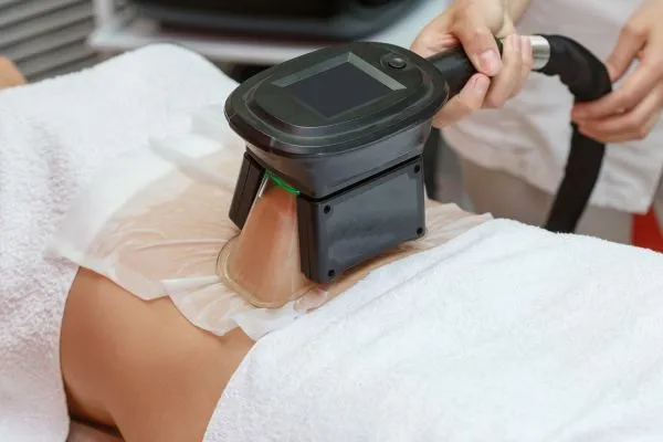 Image of person having fat freezing treatment to help weight gain East Kilbride