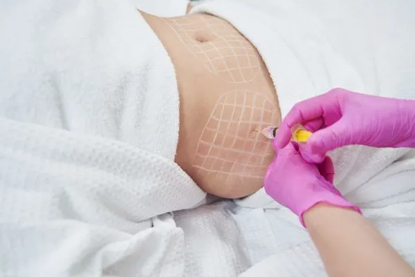 image of fat dissolving injections on love handles to help combat weight gain East Kilbride